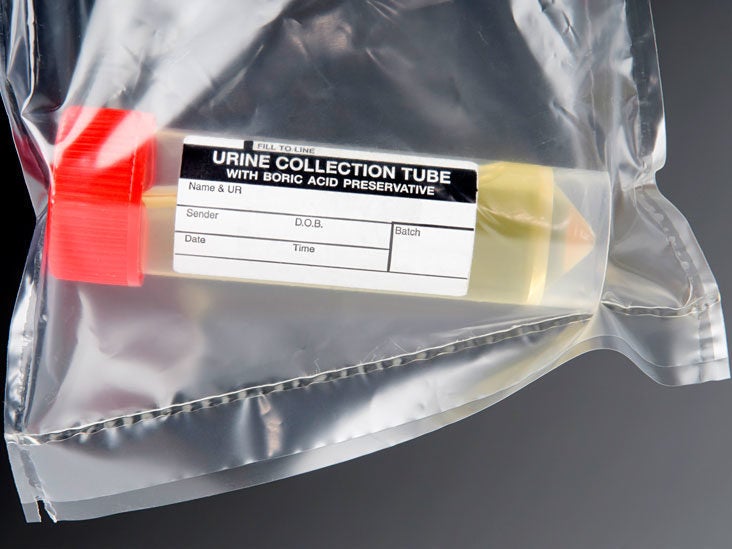 Urine Toxicology Cup at Steven Helms blog