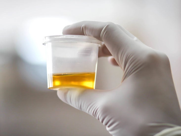 acid uric urinar cum să tratezi prostatita uretrita