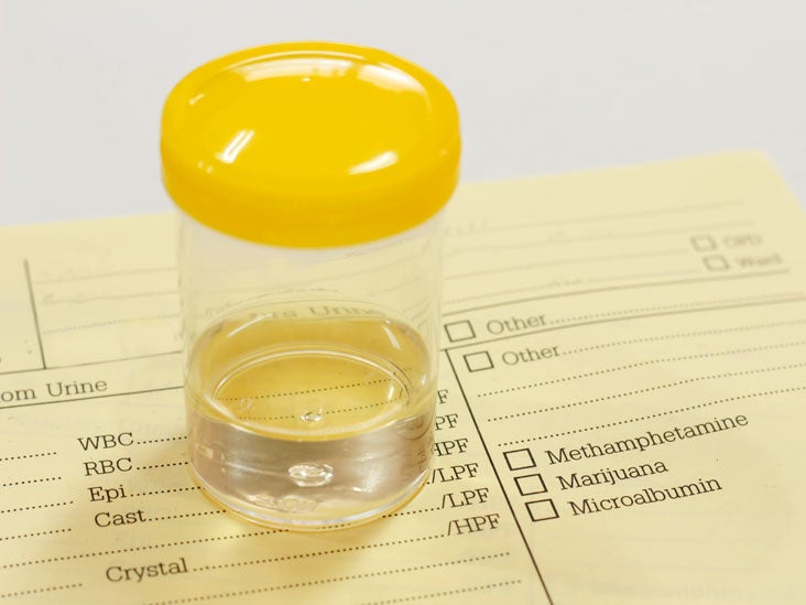 Clean Catch Urine Sample And Culture