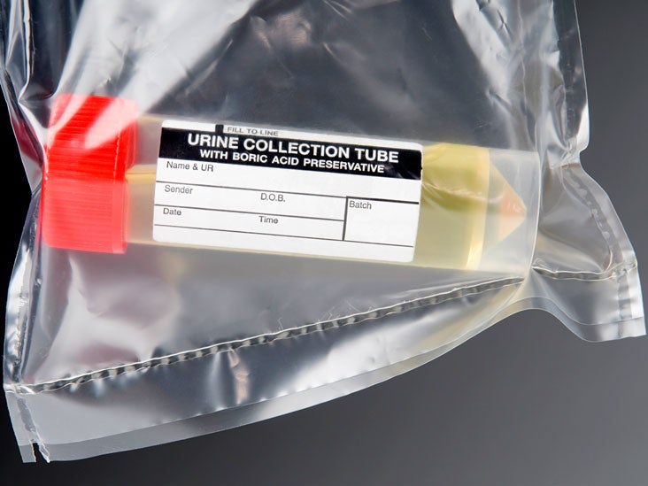 Urine Drug Test Purpose, Types, and Procedure