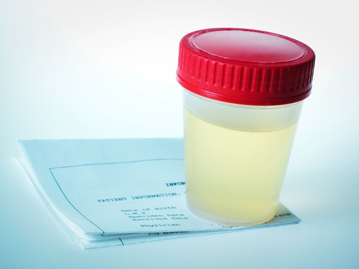 Uroflowmetry Purpose, Procedure, and Results