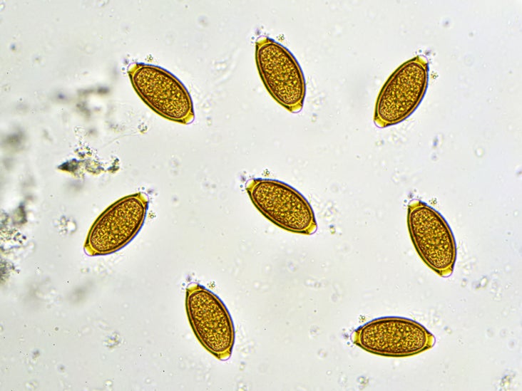 trichocephalosis anaemia