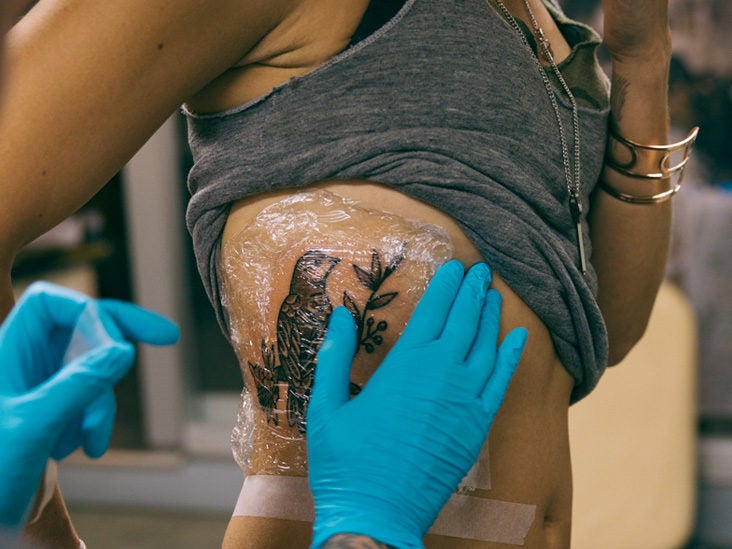 Pimple on Tattoo: Is It Safe to Pop or Treat?