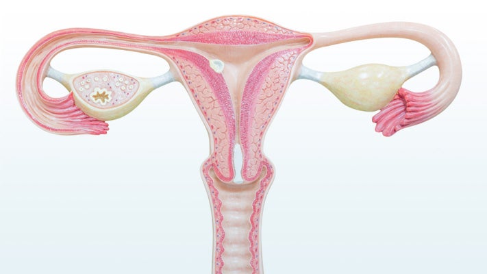 Uterus Transplants Raise Hopes As Well As Ethical Concerns