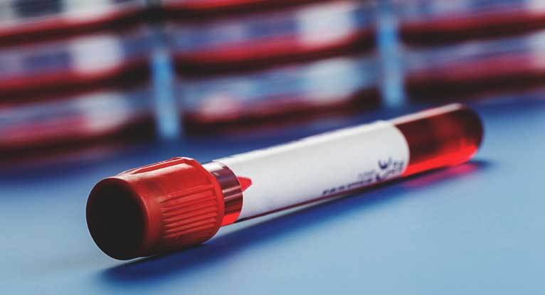 new-study-a-blood-test-can-predict-severity-of-covid-19-logical-daily