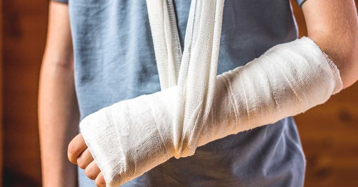 First Aid for Broken Bones and Fractures