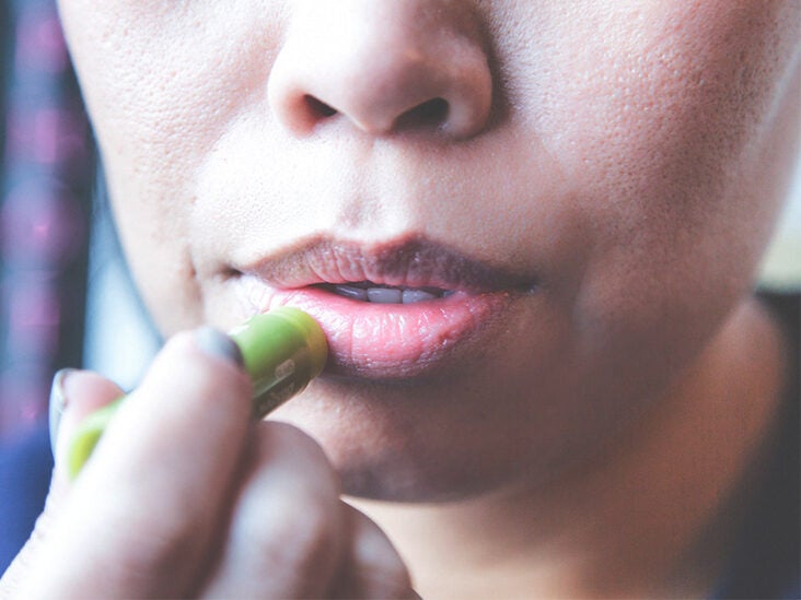 Swollen lips home remedies for How to