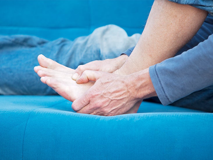 Tailor S Bunion Treatment Causes Prevention And More