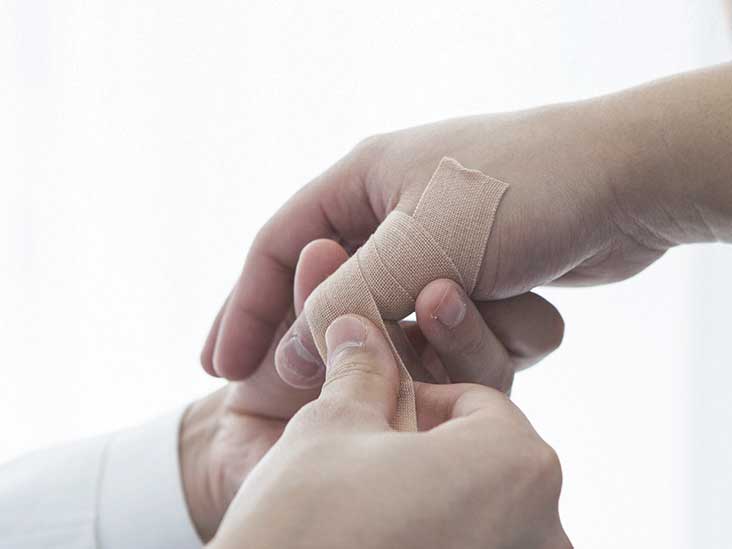 Sprained Thumb Treatment, Recovery, Symptoms, and More