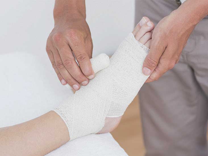 hairline fracture in foot treatment