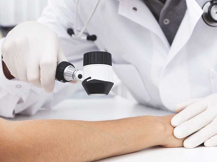 Is Your Rash Caused By Hepatitis C