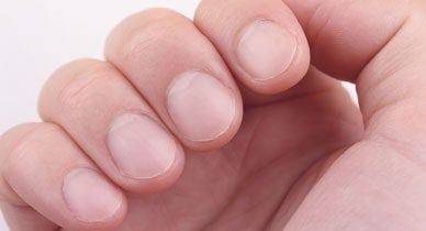 Half Moon Nails Why You Do Or Don T Have It Symptoms To Watch For