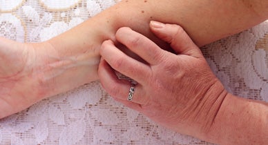 Treating Psoriasis with Injections: Know Your Options