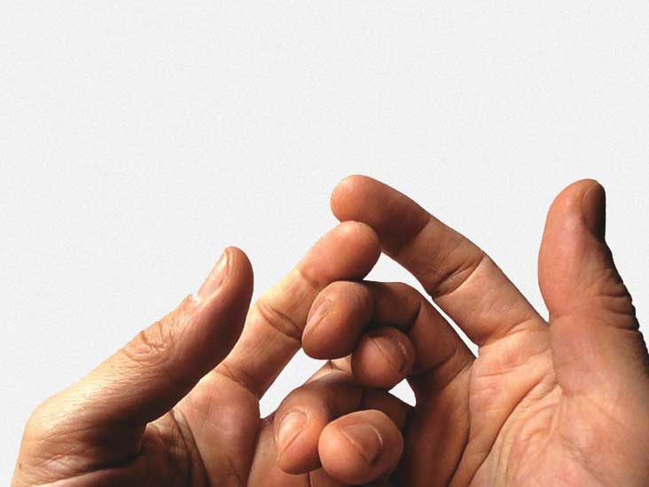 swollen-hands-exercise-other-causes-and-treatment