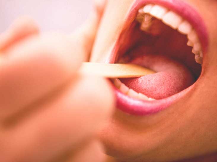 Tightness In Throat Causes Treatment And More