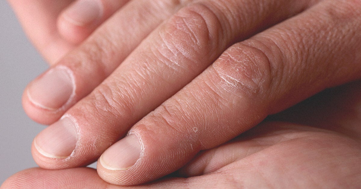 What Does Two Black Painted Fingernails Mean