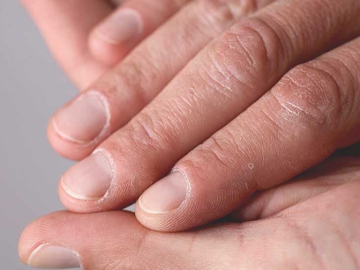 Blue Fingernails: Causes and When to Get Help