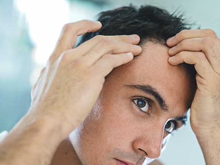 Folliculitis Decalvans: Pictures, Treatments, Symptoms, and Causes