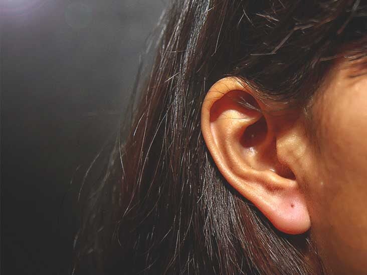 plaque psoriasis behind ears treatment)