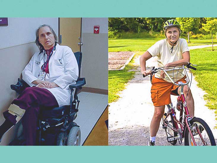How This Doctor With Ms Went From A Wheelchair To Walking