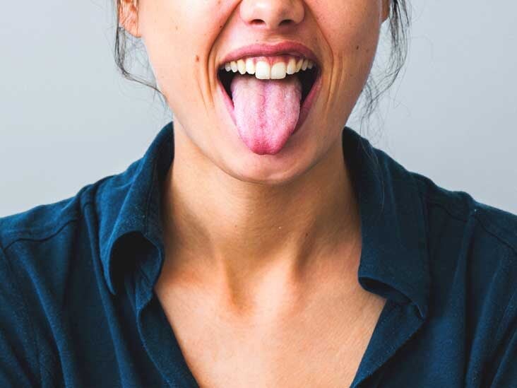 Black Tongue: What Causes a Black Tongue and How to Get Rid of It