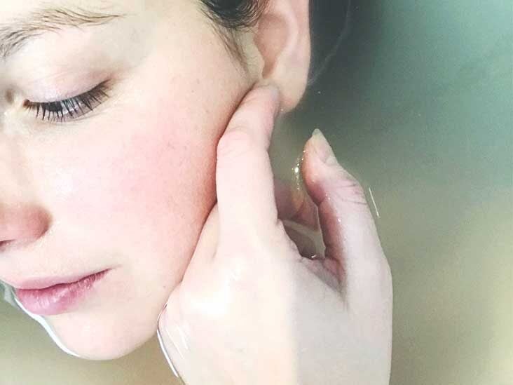 How to Pop a Cyst: On Your Face, Back, At Home, and More