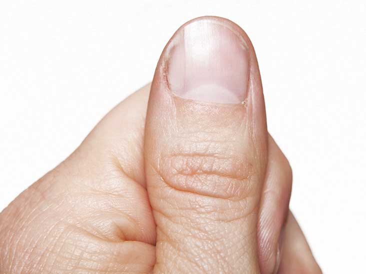 finger finger nail