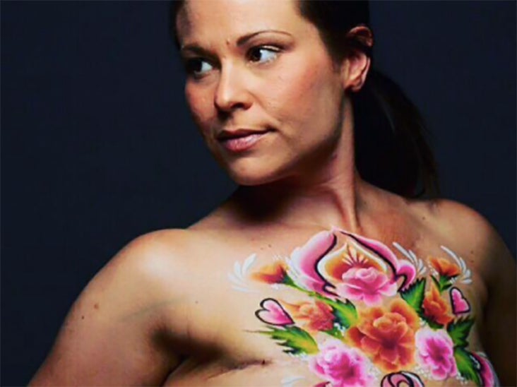 Learning to Love My Body After Breast Cancer