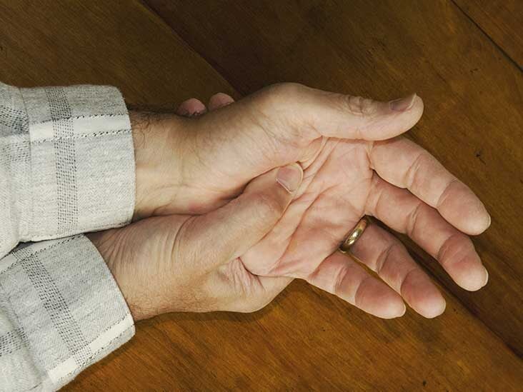 Psoriatic Arthritis Mutilans: Causes, Symptoms, and Treatment