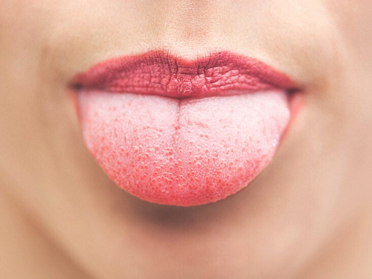 are warts on tongue dangerous)