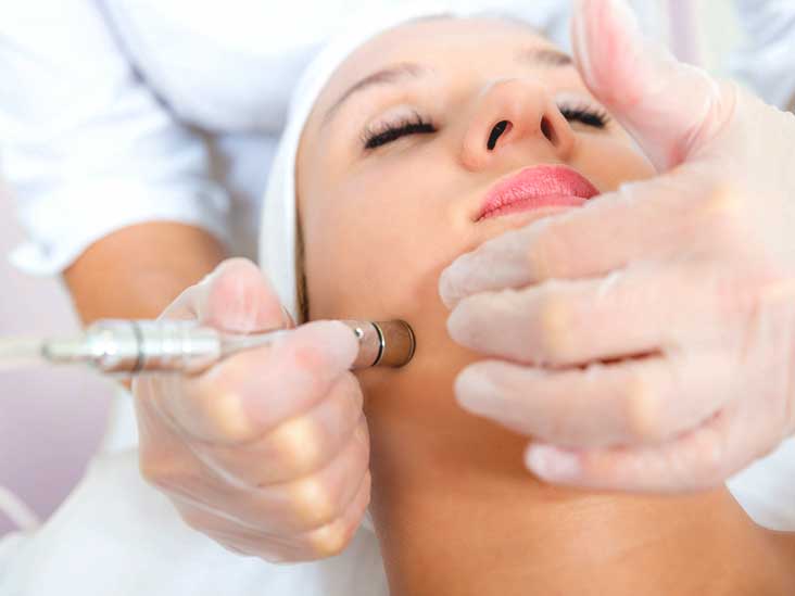 Microdermabrasion: Procedure, Side Effects, and Cost