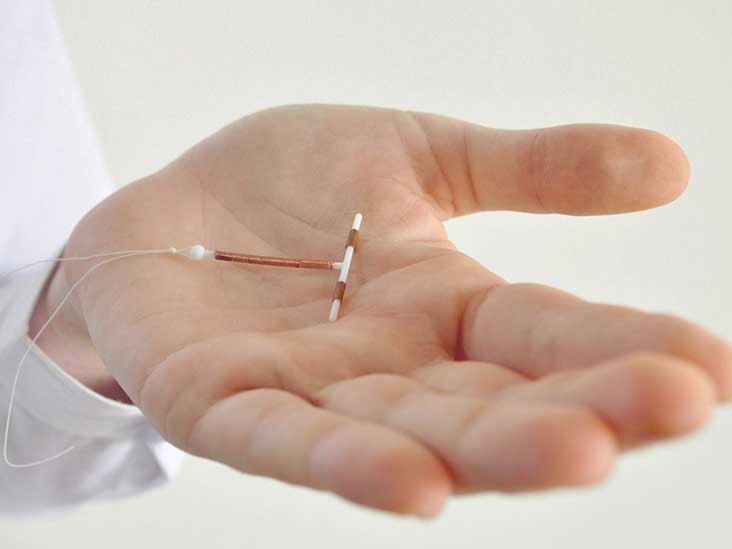 Iud Fell Out
