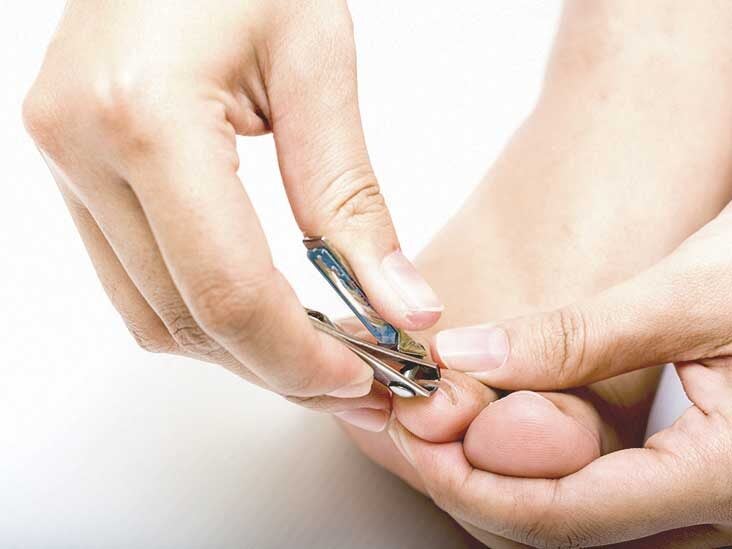 Toenail Fungus Home Remedies