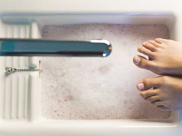 Foot Corn Causes, Treatment, and More