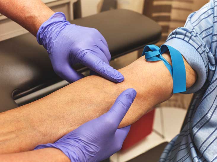 fasting blood test for cholesterol how long to fast