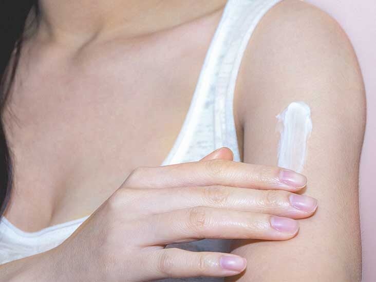 The 8 Best Remedies for Itching