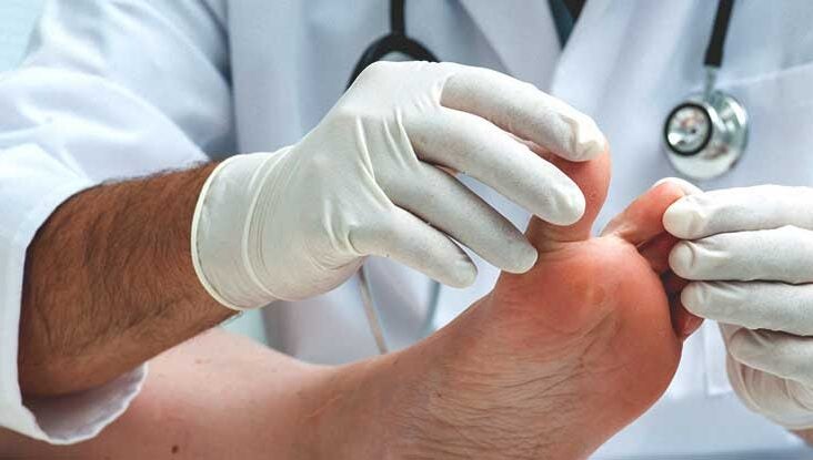 Broken Toe: Symptoms, Recovery, and More