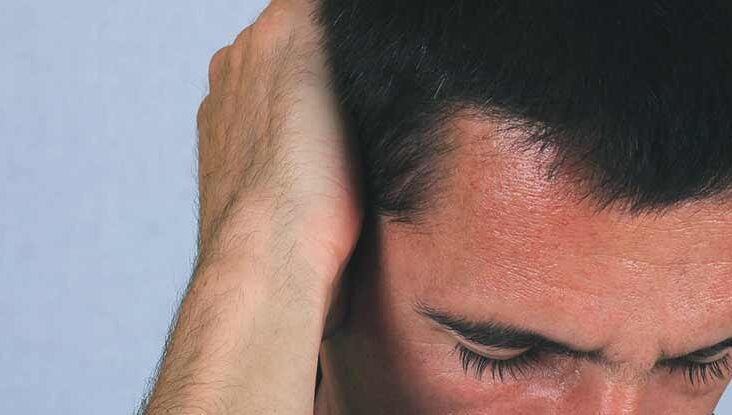 Headache Behind The Ear Causes Treatment And More