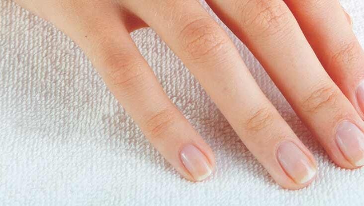 White Spots on the Nails: Causes and More
