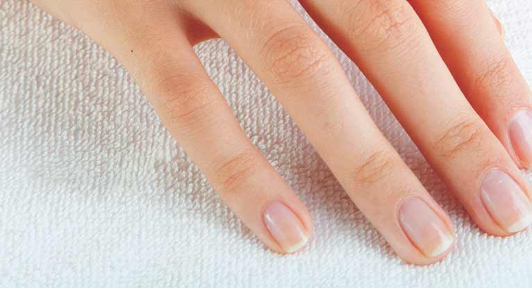 white-spots-on-the-nails-causes-and-more