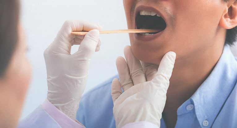 White Spots On Tonsils Causes Symptoms Treatment Risks