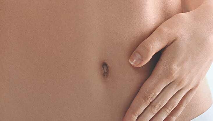 Bleeding Bellybutton: Causes, Treatment, and More