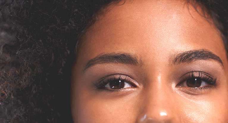 no xerophthalmia meaning
