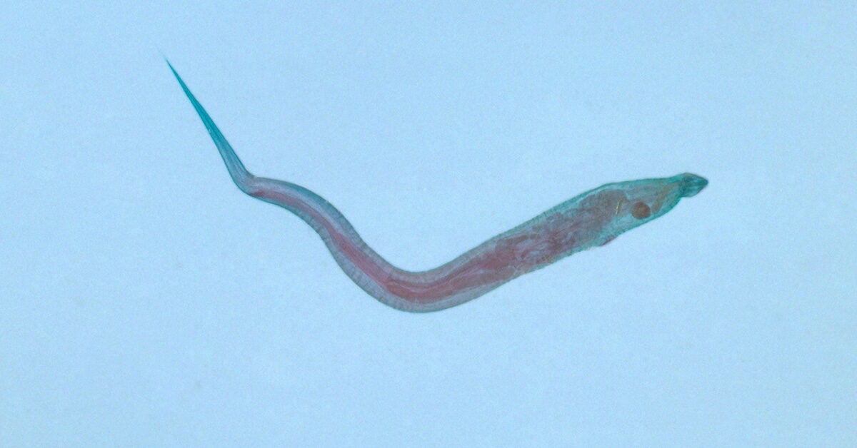 pinworm vulvovaginitis gobik férgekkel