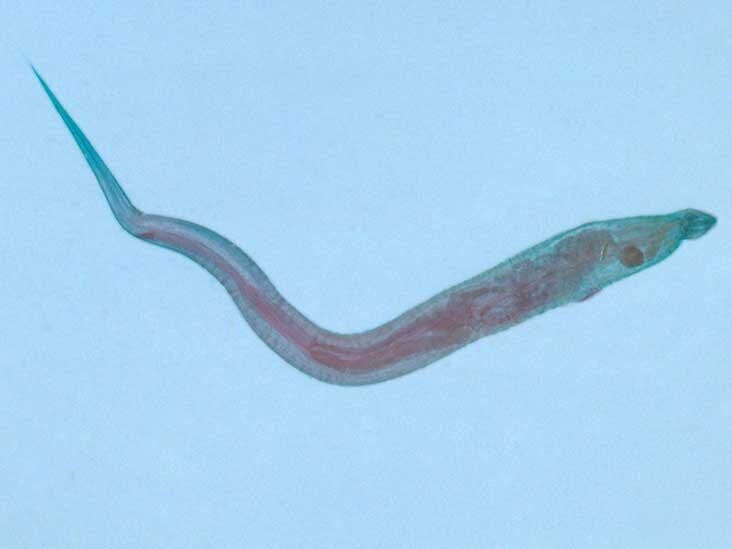 pinworms peroxid