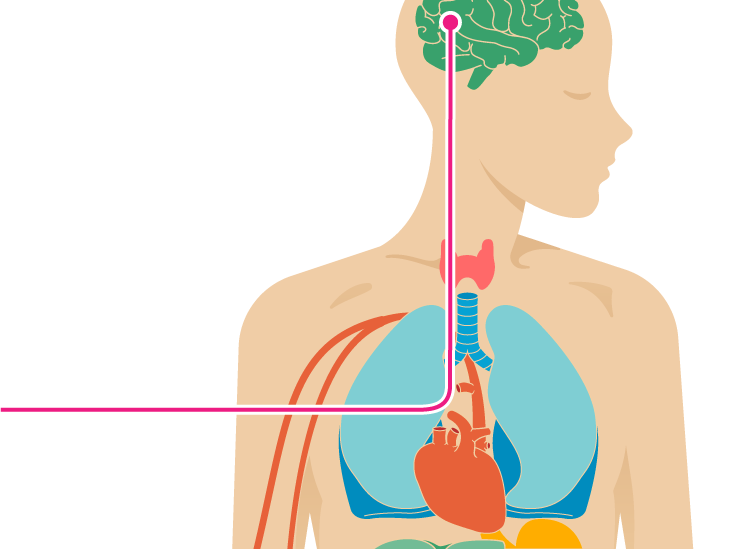 effects-of-anxiety-on-the-body-effect-choices