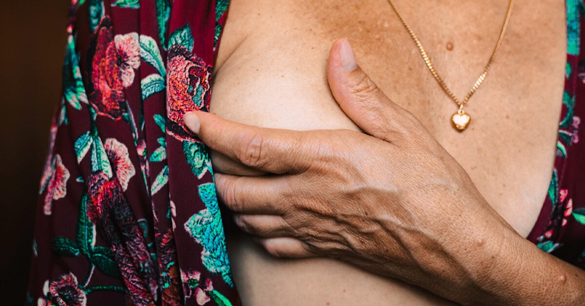 Six Overlooked Signs of Breast Cancer