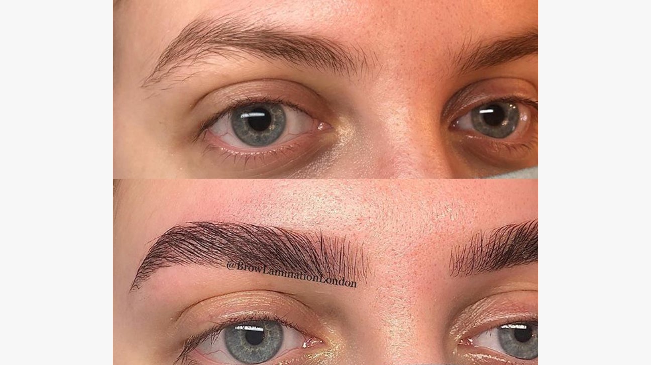 Brow Lamination Procedure Benefits Risks Costs And Pictures