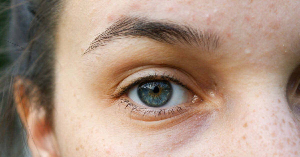 how to fix uneven eyelids