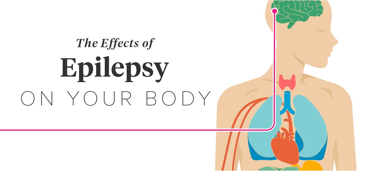 The Effects Of Epilepsy On The Body